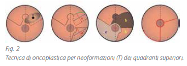 ricostruzione-2